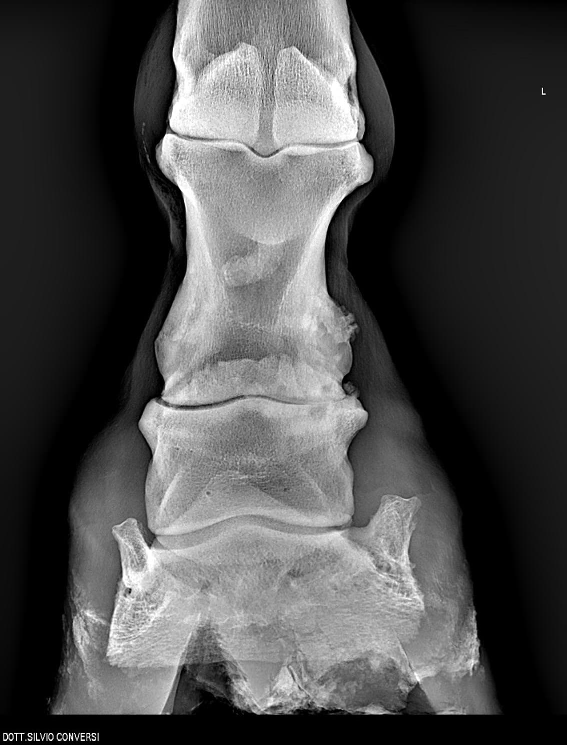 Esame radiografico